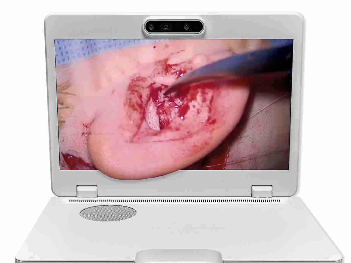 达擎之＂Heads-up 3D显微手术显示系统＂，，，，整合4K裸眼3D显示及眼球追踪系统，，具备快速追踪人眼移动位置功能，，，，减轻医师长时间维持固定姿势的负担，，，让医师能有更宽广清晰的3D立体视野及更舒适的姿势来执行手术。。。